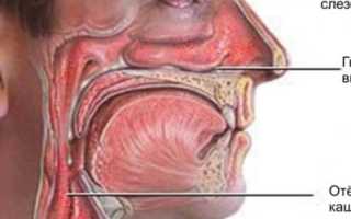 Что это такое подслизистая вазотомия нижних носовых раковин