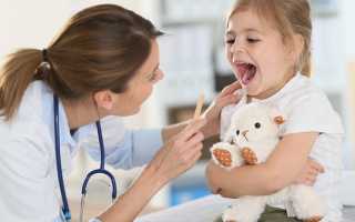 Герпетическая ангина у ребёнка и взрослого: симптомы и лечение