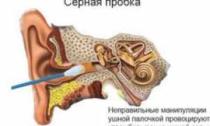 Заложило ухо что делать, чем закапать, чтобы отложило