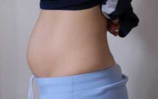 Опоясывающий лишай при беременности: стоит ли бить тревогу?