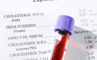Что такое анализ крови на холестерин, какова его норма и причины повышения?