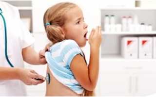 Признаки и симптомы коклюша у ребёнка до года