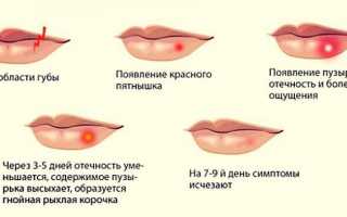 Эффективные и быстрые способы лечения герпеса на губах