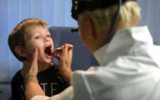 Растворы для полоскания горла у детей и взрослых при ангине