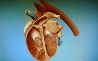 Ишемическая кардиомиопатия: симптомы и опасности
