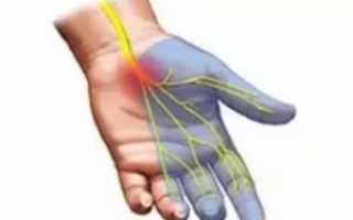 Причины и лечение онемения пальцев и кистей рук