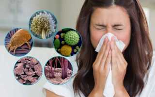 Аллергический ринит – лечение народными средствами, симптомы, аллергены