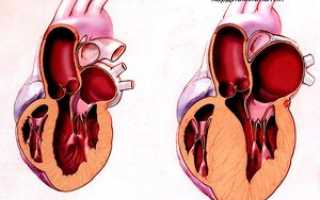 О чем говорит колющая боль в области сердца?