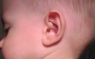 Что такое козелок уха. Боль при его надавливании