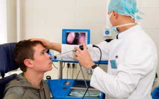 Как лечить полипы в носу и можно ли обойтись без операции?
