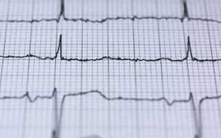 Клинические рекомендации и образ жизни при постинфарктном кардиосклерозе