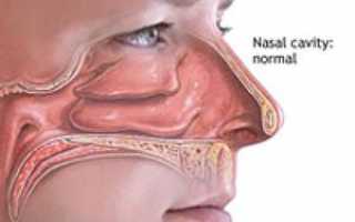 Что значит гиперемирована слизистая носа