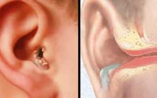 Болит горло и отдает в ухо: причины патологии и способы ее устранения