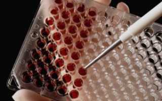 Все про анализы крови на вирусы: показания и расшифровка (ИФА, ПЦР)