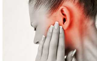 Заложенность в ушах без боли и другие симптомы: лечение