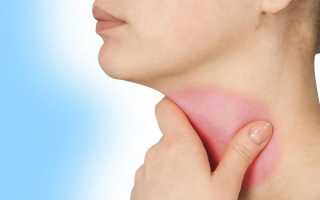 Симптомы рака горла