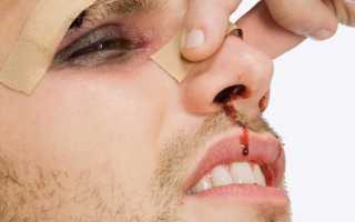 Перфорация носовой перегородки: чем опасно это состояние и как его лечить?