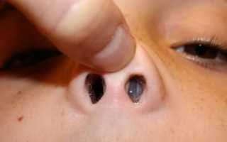 Чем мазать болячки в носу: причины их появления и лечение