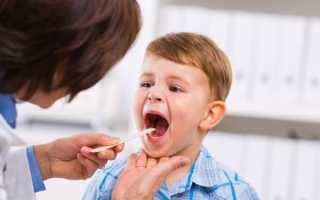 Рыхлое горло: причины и лечение