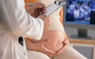 Вирус Эпштейн-Барр в острой и хронической формах при беременности