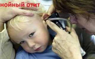 Отит у детей: лечение и профилактика — доктор Комаровский