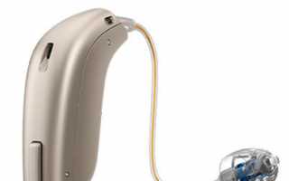 Сколько стоит слуховой аппарат и где его купить?