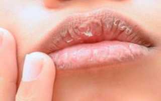 Витамины для губ от заед, трещин и сухости