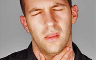 Сухость в горле: причины и лечение, о какой болезни говорит