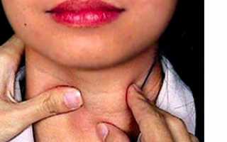 Признаки заболевания щитовидки и методы лечения для женщин
